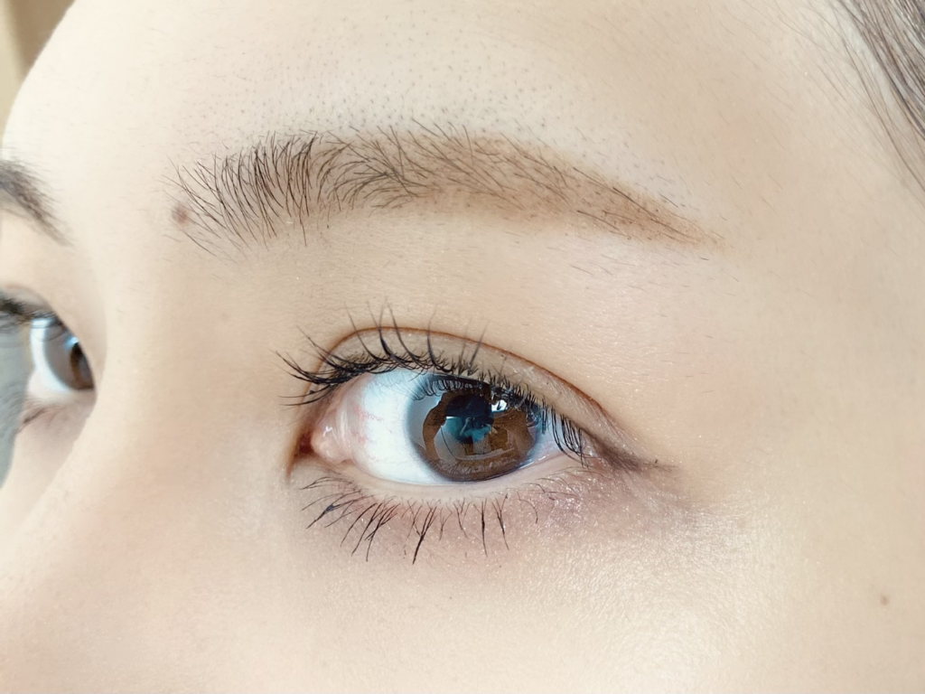 目の下のたるみを改善するセルフケアの方法