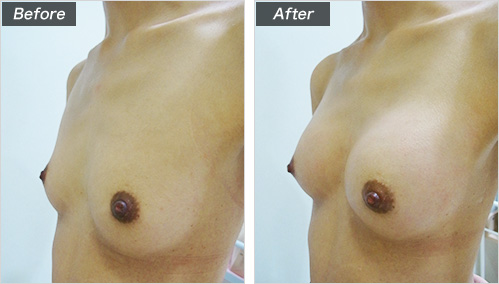 こんな方におすすめ　症例写真①