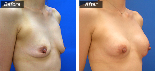 こんな方におすすめ　症例写真②