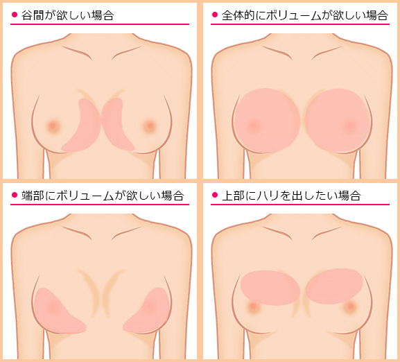 こんな方におすすめ　イラスト解説