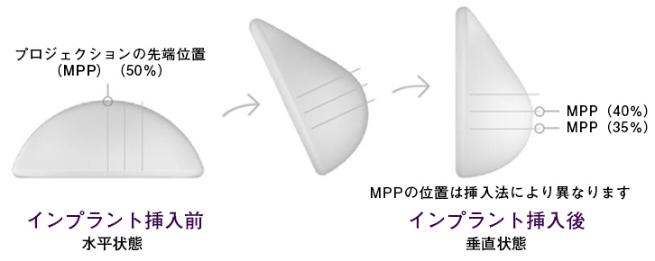 Ergonomix TrueTIssue Technology