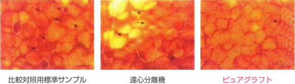 ピュアグラフ豊胸のメリット