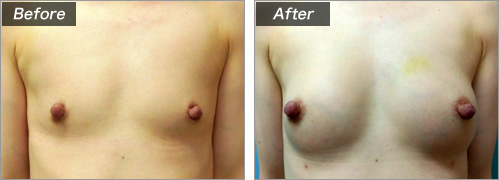 その他の症例写真　正面（術前・術後）